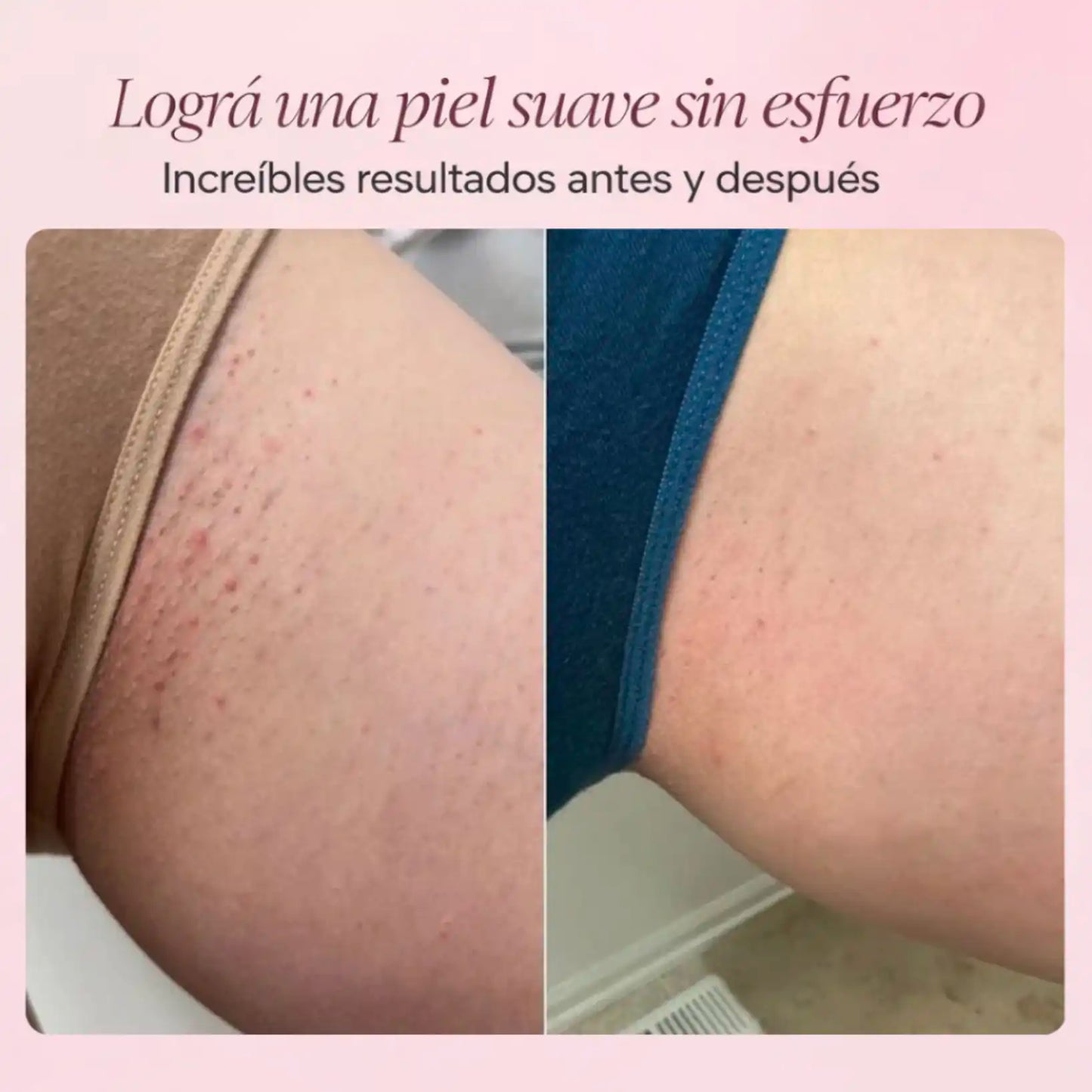 BELLAGLIDE™- Depiladora 2 en 1 + Jabon Gratis